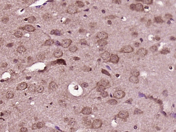 Anti-Axin-2 Polyclonal Antibody