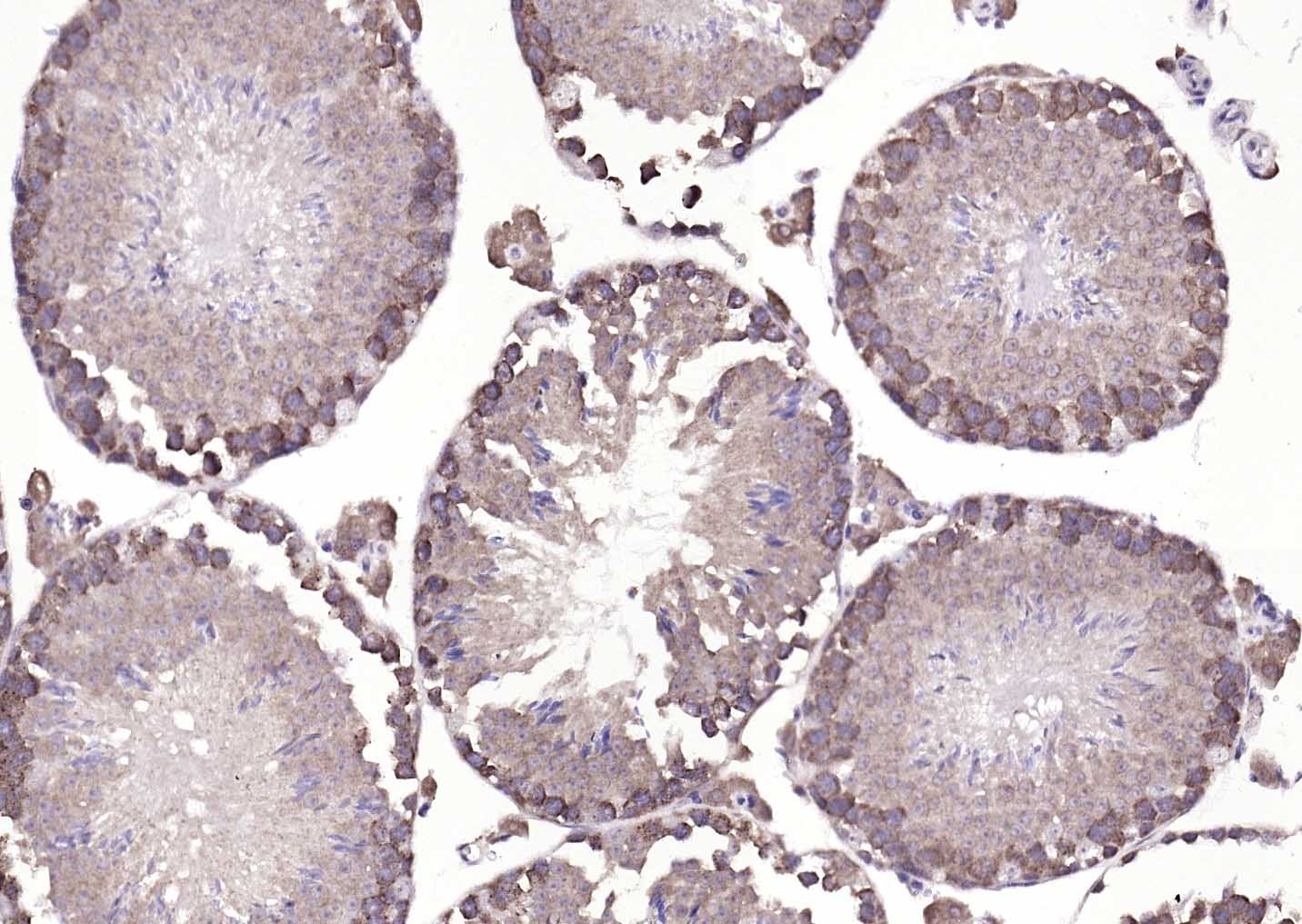 Anti-ATP7B Polyclonal Antibody