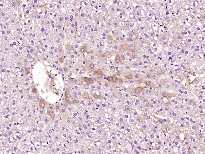Anti-ATP7B Polyclonal Antibody