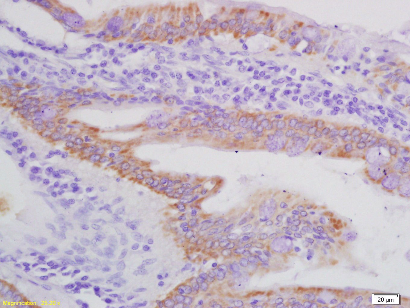 Anti-AXL Polyclonal Antibody