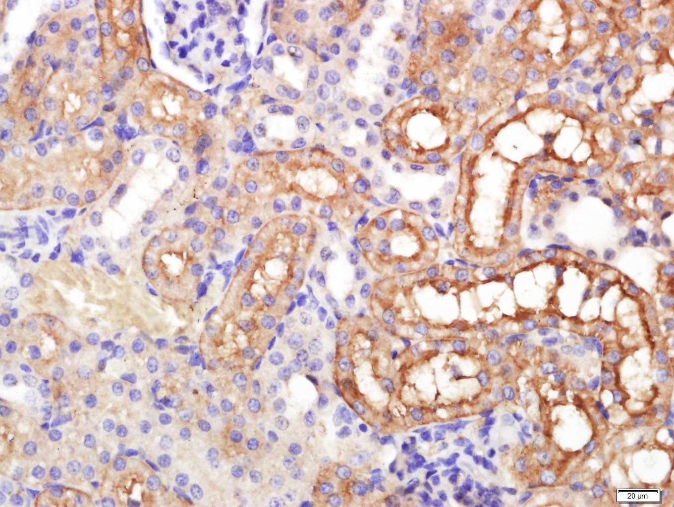 Anti-Aquaporin-1/AQP1 Polyclonal Antibody