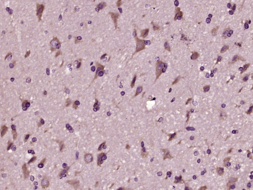 Anti-Aβ1-42 (CT) Polyclonal Antibody
