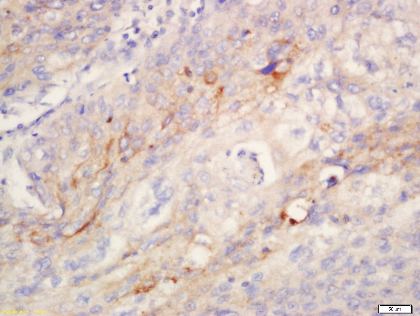 Anti-Anoctamin-1/ANO1 Polyclonal Antibody