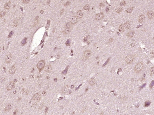 Anti-ATP7A Polyclonal Antibody