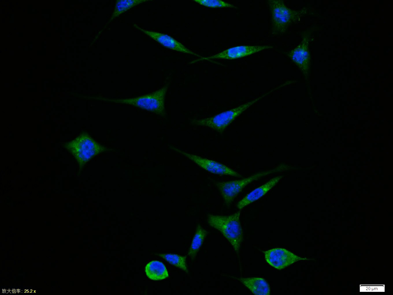 Anti-APAF1(NT) Polyclonal Antibody