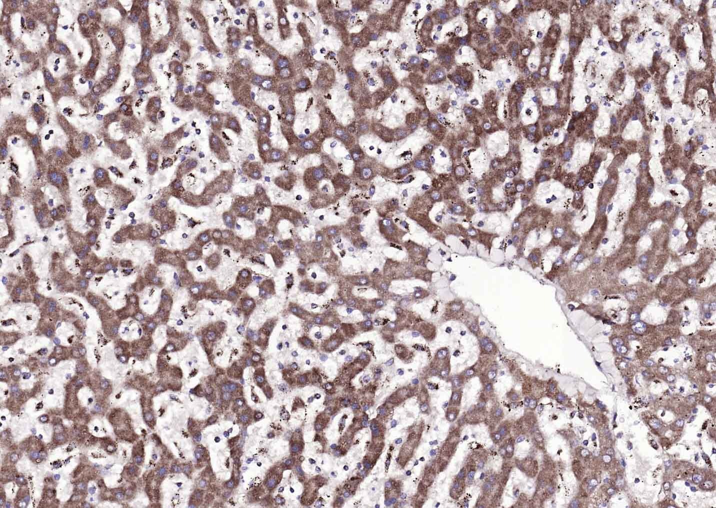 Anti-ATP7B Polyclonal Antibody
