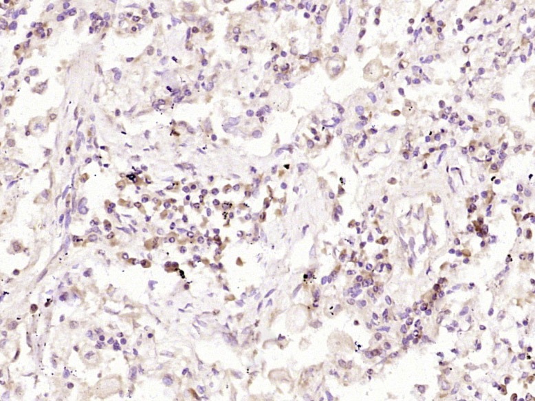 Anti-Aquaporin-4/AQP4 Antibody (8G264)
