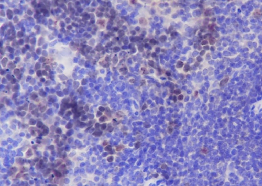 Anti-Aurora B Antibody (9I737)