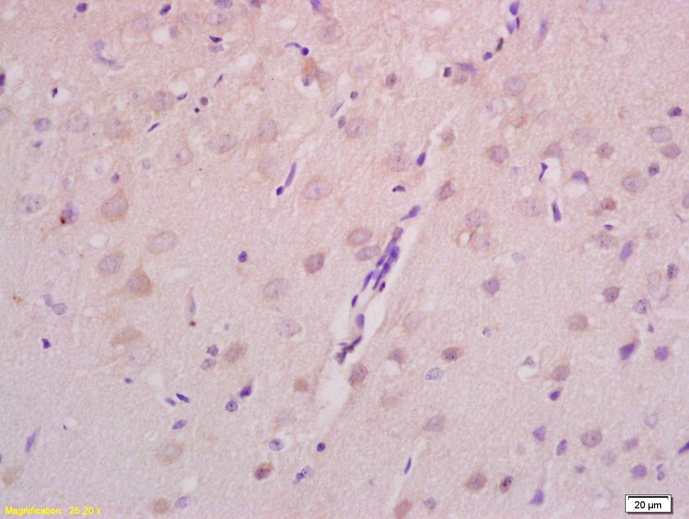 Anti-Axin-2 Polyclonal Antibody