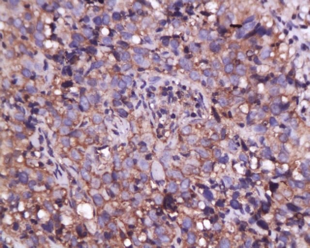 Anti-ANXA1 Polyclonal Antibody