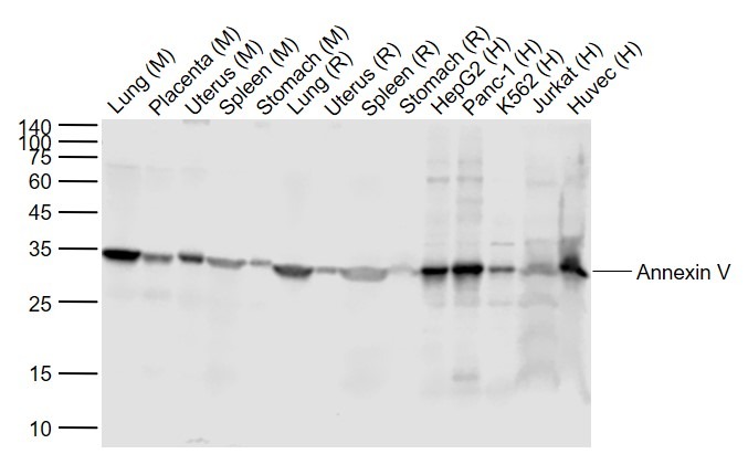 Anti-Annexin V/ANXA5 Antibody (6U449)