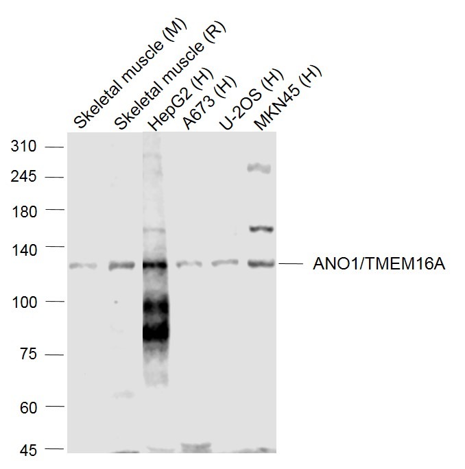 Anti-Anoctamin-1/ANO1 Polyclonal Antibody