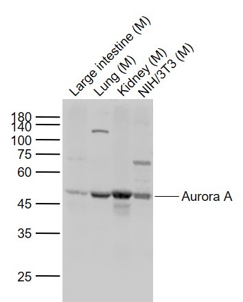 Anti-AURKA Polyclonal Antibody