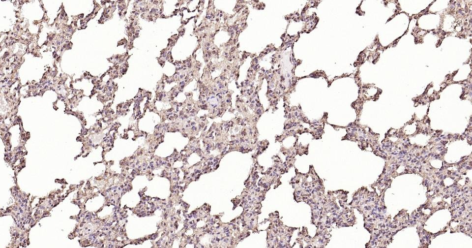 Anti-Calreticulin Antibody (3C852)