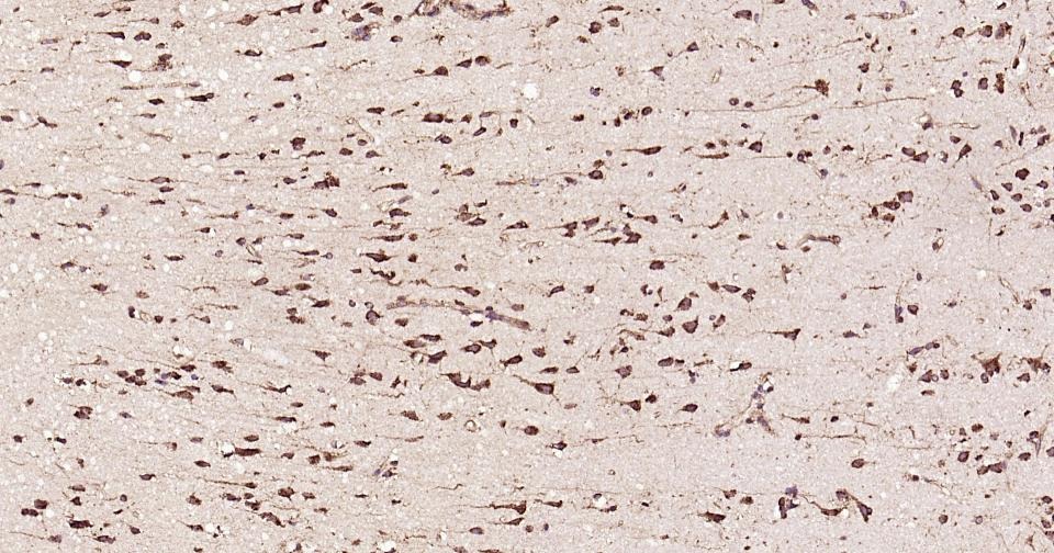 Anti-Calreticulin Polyclonal Antibody