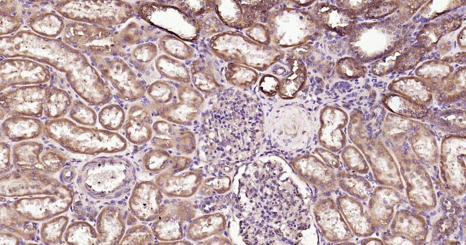 Anti-Calreticulin Polyclonal Antibody
