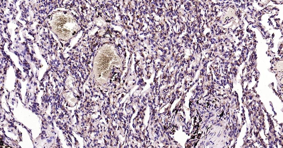 Anti-Calreticulin Polyclonal Antibody