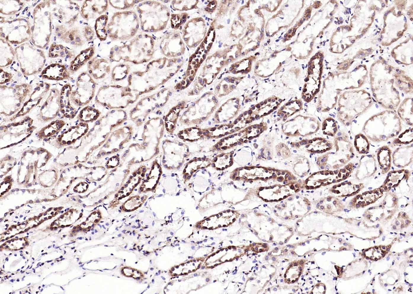 Anti-Calreticulin Antibody (6Q988)
