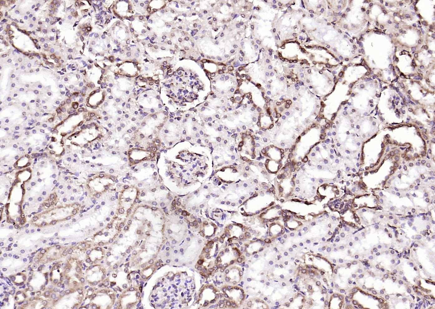 Anti-Calreticulin Antibody (6Q988)