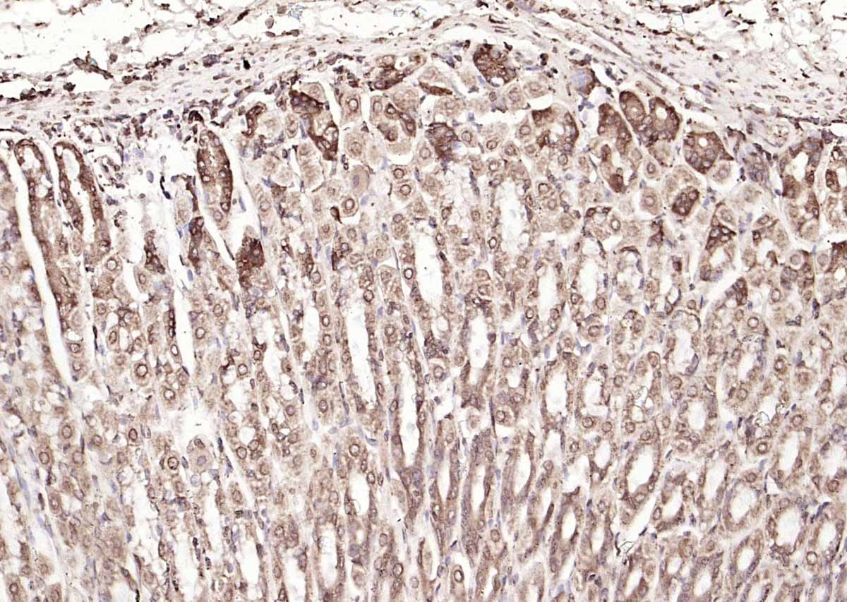 Anti-Calreticulin Antibody (6Q988)