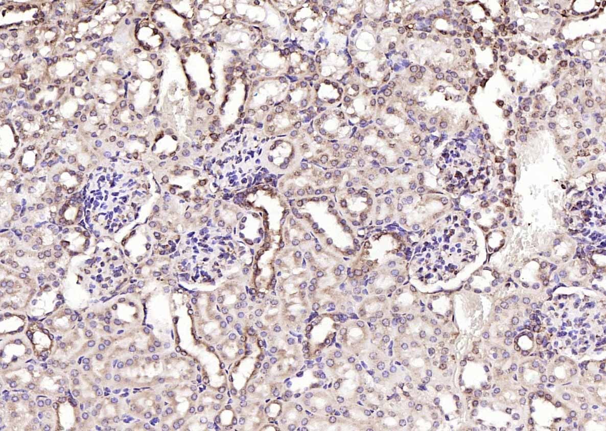 Anti-Calreticulin Antibody (6Q988)