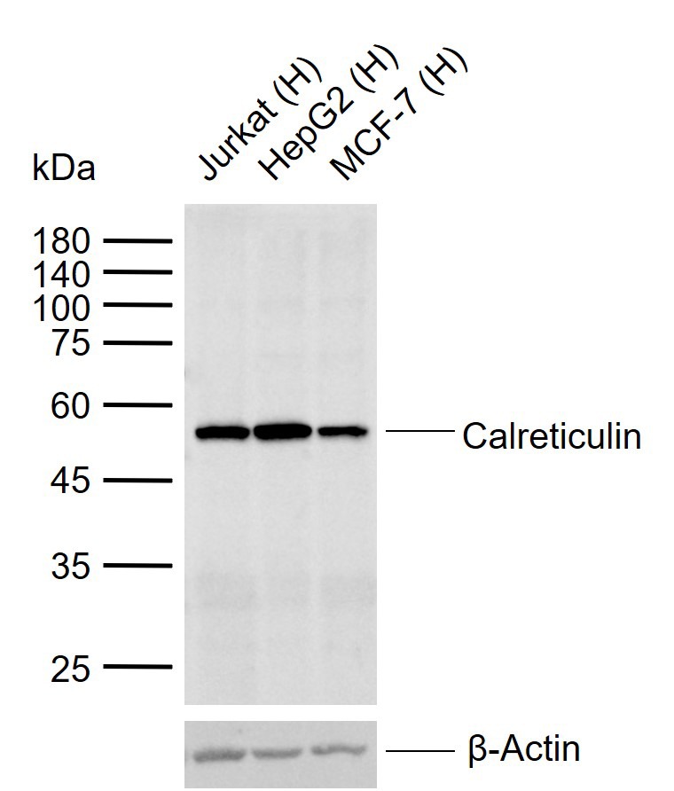Anti-Calreticulin Polyclonal Antibody