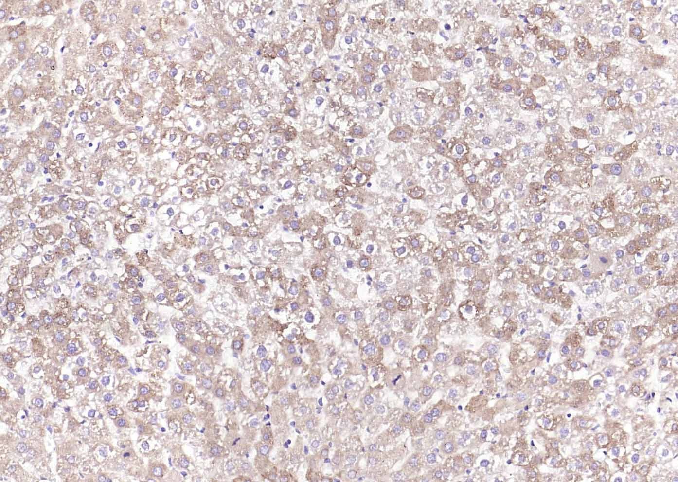 Anti-Calreticulin Antibody (6Q988)