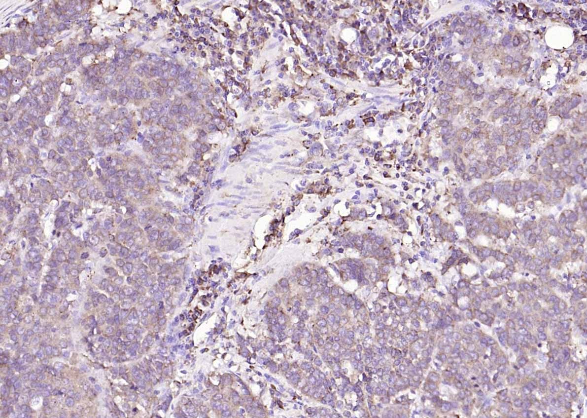 Anti-Calreticulin Antibody (6Q988)