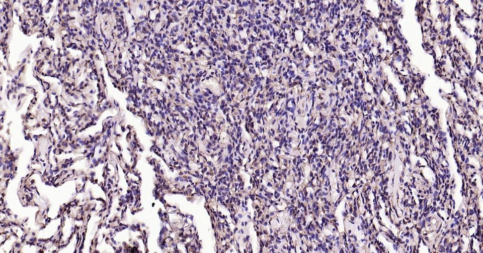 Anti-Calreticulin Antibody (3C852)