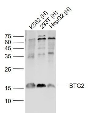 Anti-BTG2 Polyclonal Antibody