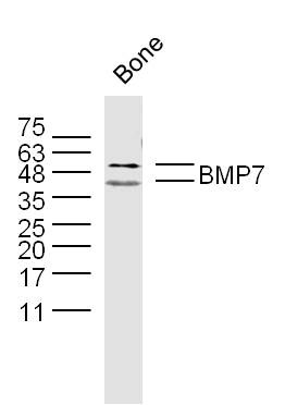 Anti-BMP-7 Polyclonal Antibody