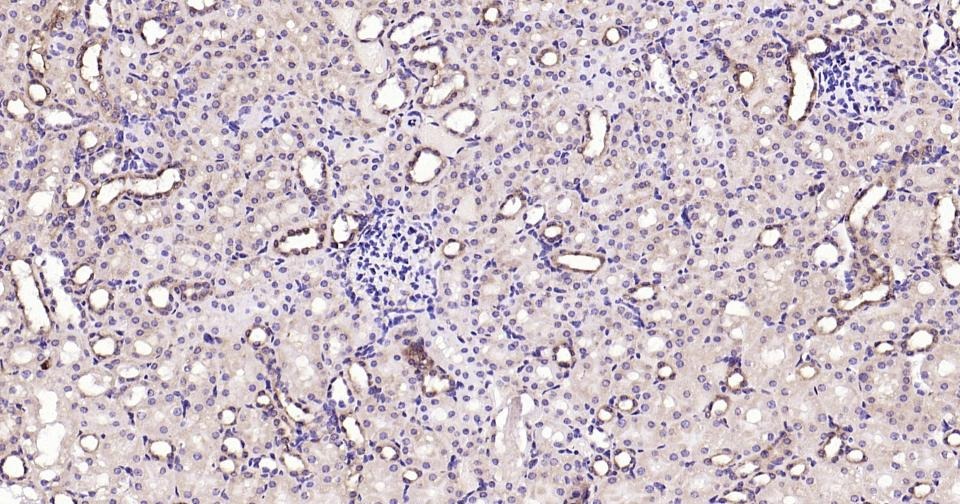 Anti-Calreticulin Antibody (3C852)