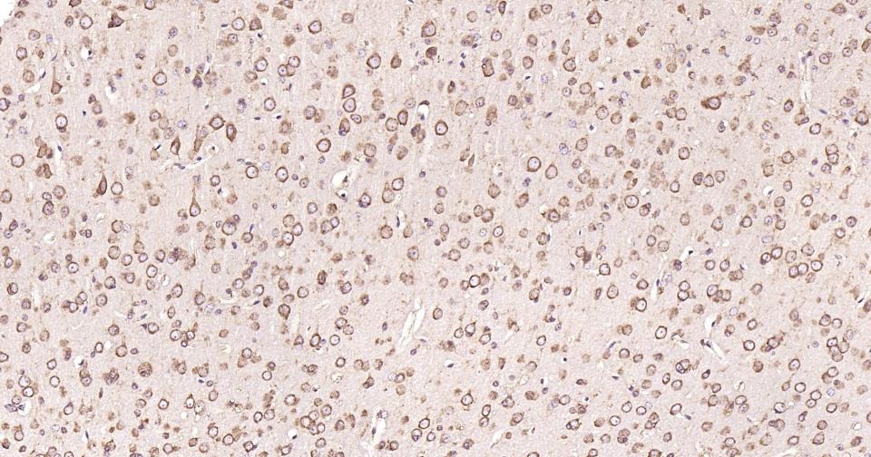 Anti-Calreticulin Antibody (3C852)