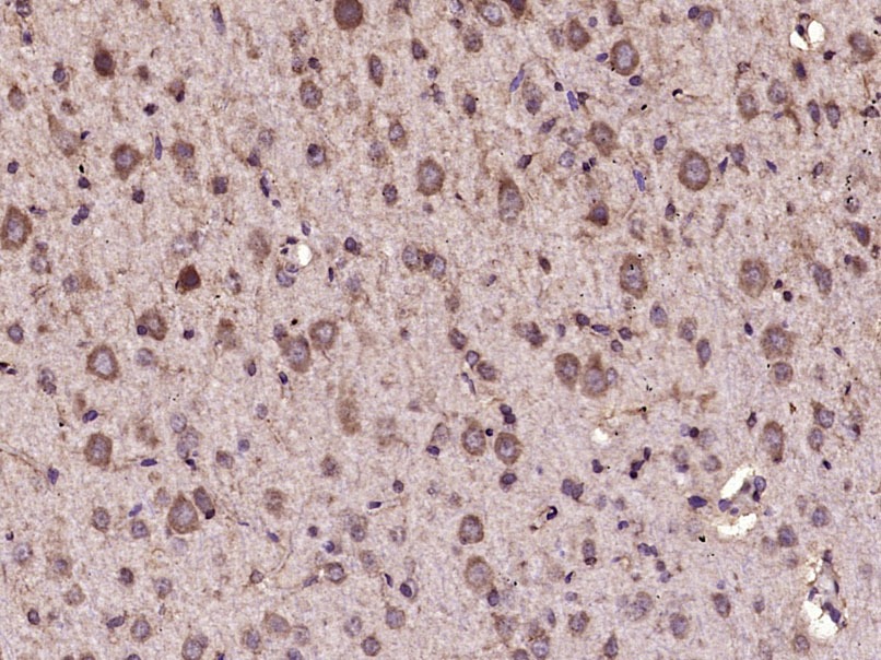 Anti-CAMKK2 Polyclonal Antibody