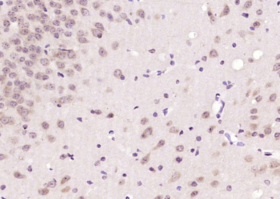 Anti-CAMTA1 Polyclonal Antibody