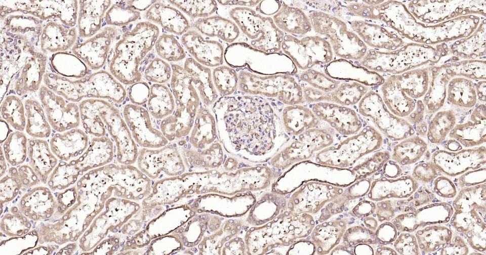 Anti-Calreticulin Antibody (3C852)