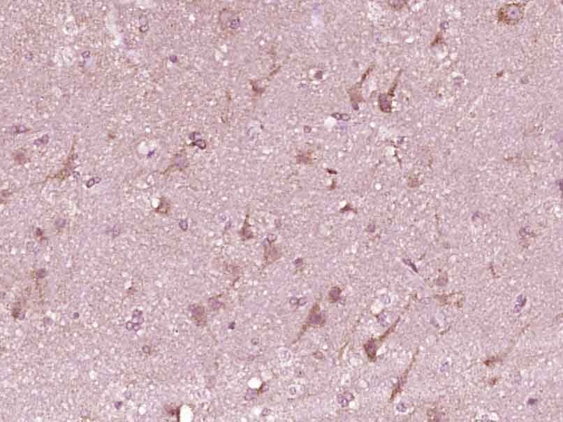 Anti-BMAL1 Polyclonal Antibody