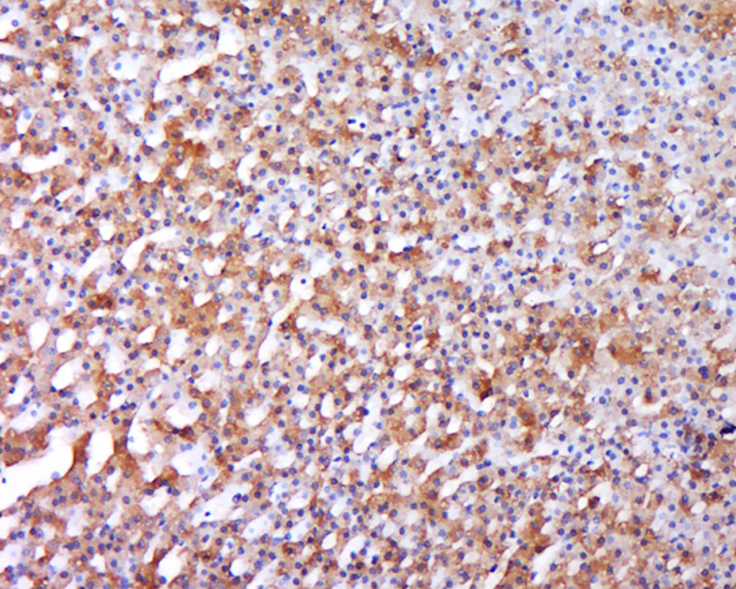 Anti-BMP-1 Polyclonal Antibody