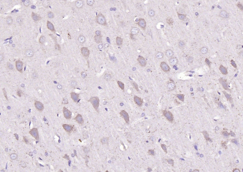 Anti-BMAL1 Polyclonal Antibody