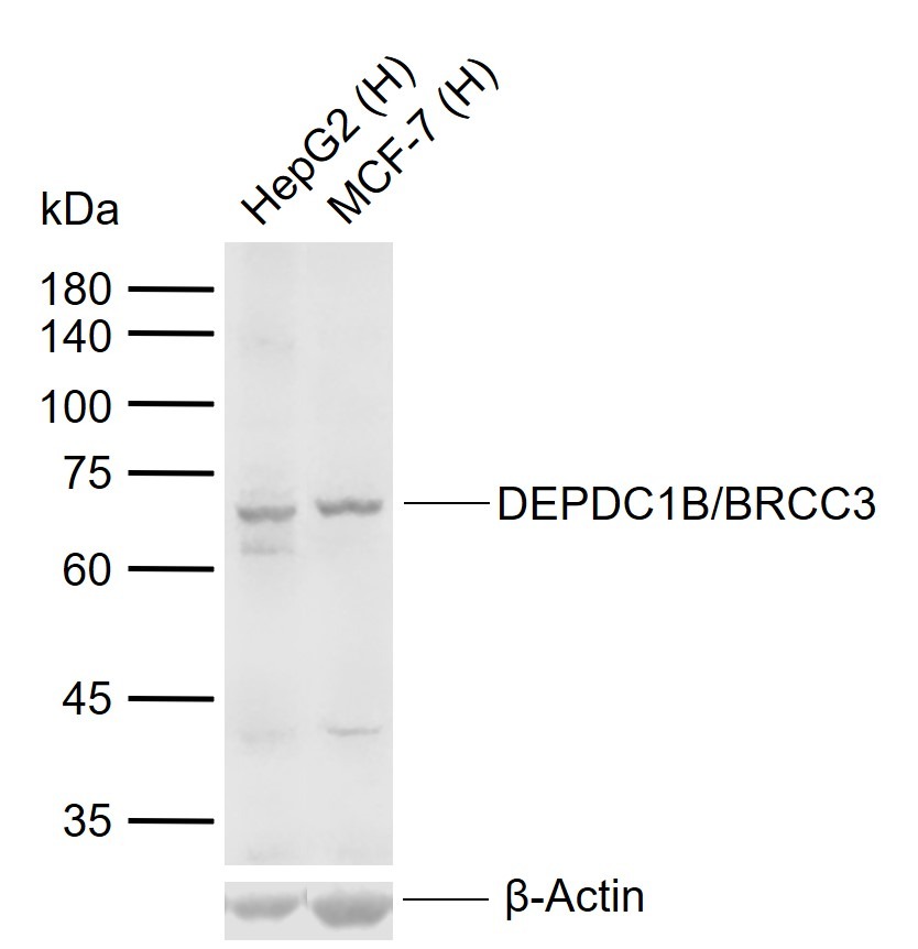 Anti-DEPDC1B/BRCC3 Polyclonal Antibody