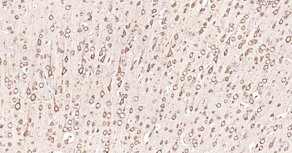 Anti-Calreticulin Antibody (3C852)