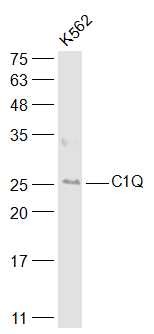 Anti-C1QA Polyclonal Antibody