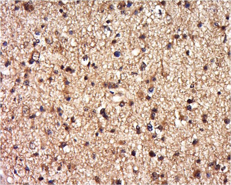 Anti-DEPDC1B/BRCC3 Polyclonal Antibody