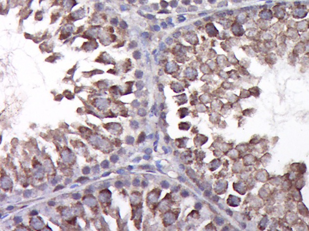Anti-CCL4 Polyclonal Antibody