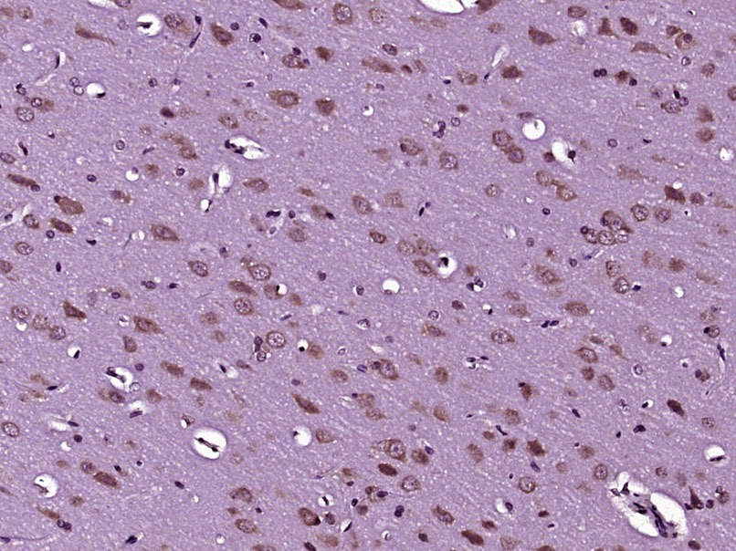 Anti-CAMK2 alpha Polyclonal Antibody 2