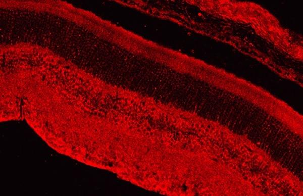 Anti-CAMTA1 Polyclonal Antibody