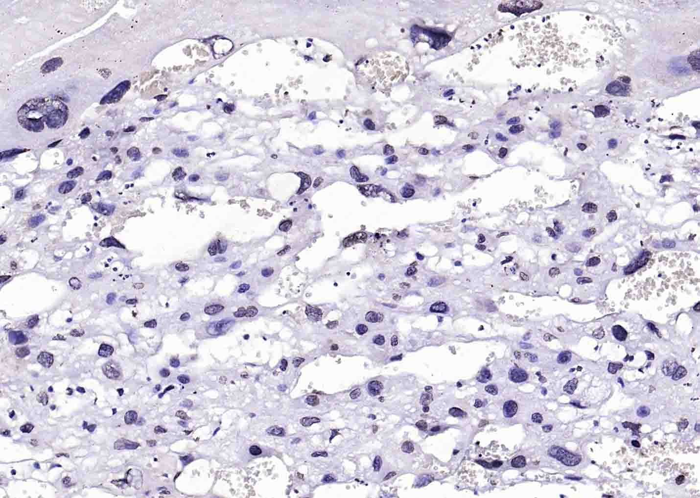 Anti-BRCA2 Polyclonal Antibody