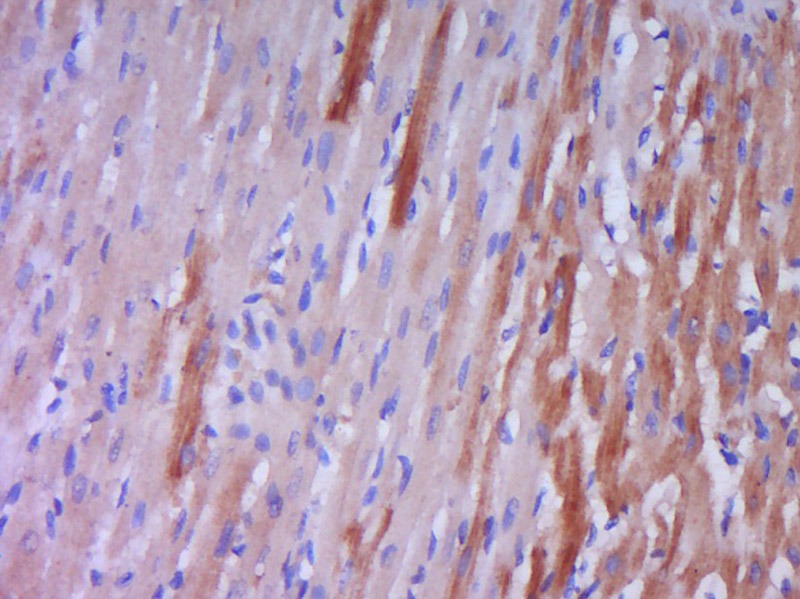 Anti-Endothelin-1/EDN1 Polyclonal Antibody
