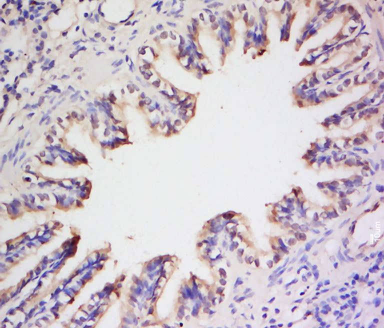Anti-Endothelin-1/EDN1 Polyclonal Antibody