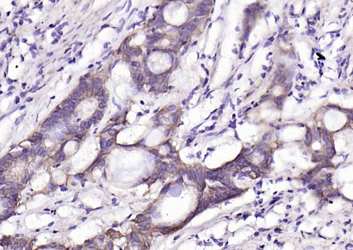 Anti-EpCAM Polyclonal Antibody 2